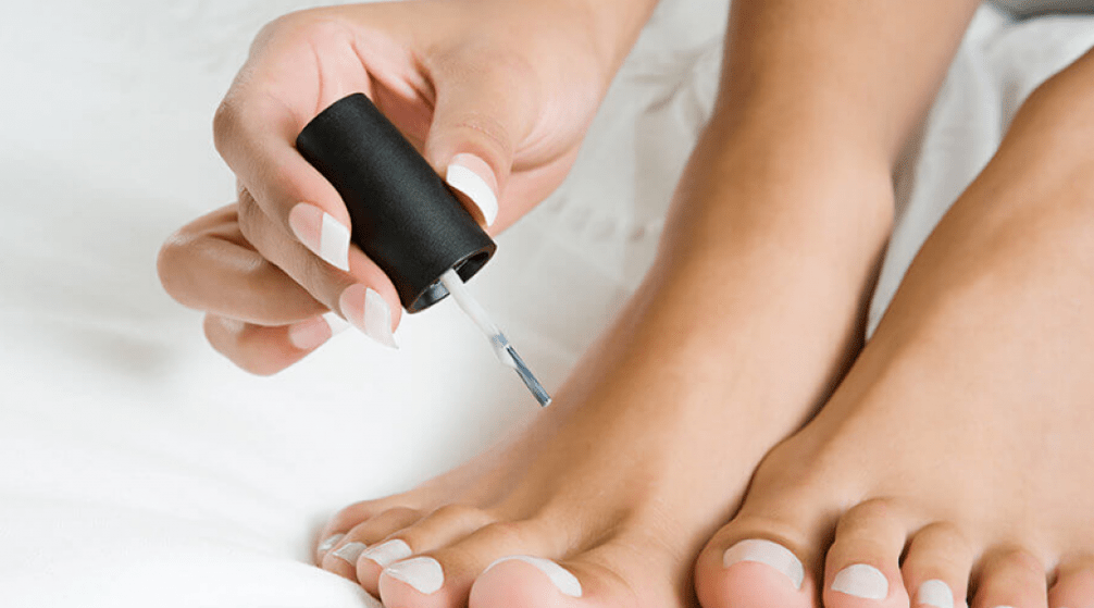 Behandlung vu Pilz op den Daumen mat Nagellack