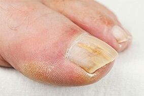 Buedem -Finger
