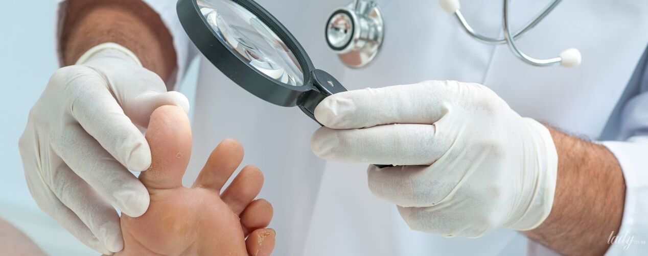Den Dokter ënnersicht de Pilz op der Zeh