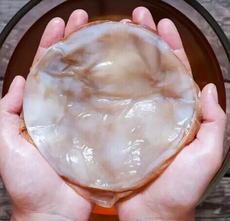 Nagelpilz kombucha